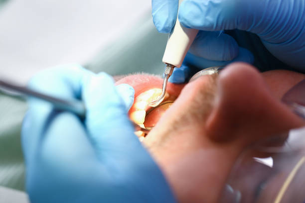 Best Emergency Root Canal Treatment in Bristol, WI